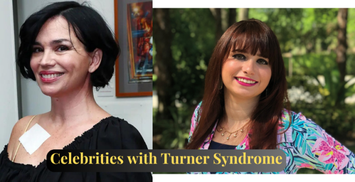 Celebrities with Turner Syndrome